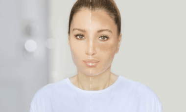 bahaya merkuri dalam kosmetik