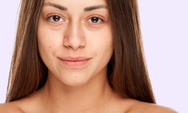 Cara mengatasi stres kulit