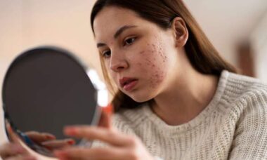 Efek buruk polusi pada wajah